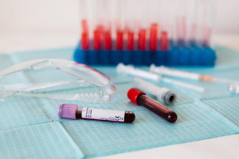 Insulineresistentie test